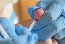 Reino Unido faz testes em larga escala para conhecer a imunidade ao coronavírus