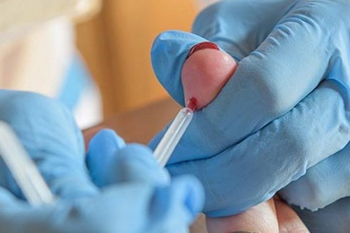 Reino Unido faz testes em larga escala para conhecer a imunidade ao coronavírus