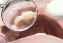 Facetas ou aparelho? Especialistas da MALO CLINIC alertam que a resposta só com um diagnóstico clínico personalizado Facetas ou aparelho? Especialistas da MALO CLINIC alertam que a resposta só com um diagnóstico clínico personalizado