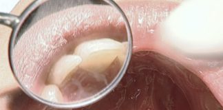 Facetas ou aparelho? Especialistas da MALO CLINIC alertam que a resposta só com um diagnóstico clínico personalizado Facetas ou aparelho? Especialistas da MALO CLINIC alertam que a resposta só com um diagnóstico clínico personalizado