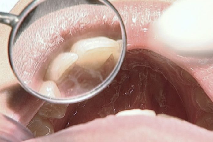 Facetas ou aparelho? Especialistas da MALO CLINIC alertam que a resposta só com um diagnóstico clínico personalizado Facetas ou aparelho? Especialistas da MALO CLINIC alertam que a resposta só com um diagnóstico clínico personalizado
