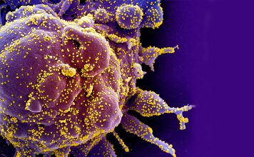 Micrografia eletrónica de varredura colorida de uma célula apoptótica (roxa) fortemente infetada com partículas do vírus SARS-COV-2 (amarela), isolada de uma amostra de paciente. Imagem capturada no NIAID Integrated Research Facility (IRF) em Fort Detrick, Maryland.