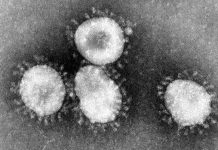 Mulher sofre reinfeção por coronavírus no Japão