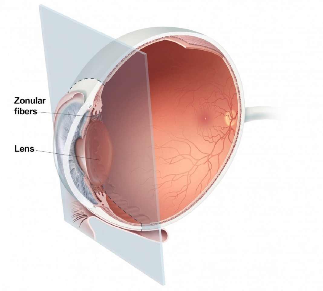 Seção transversal do olho mostrando a localização da lente e das fibras zonulares.