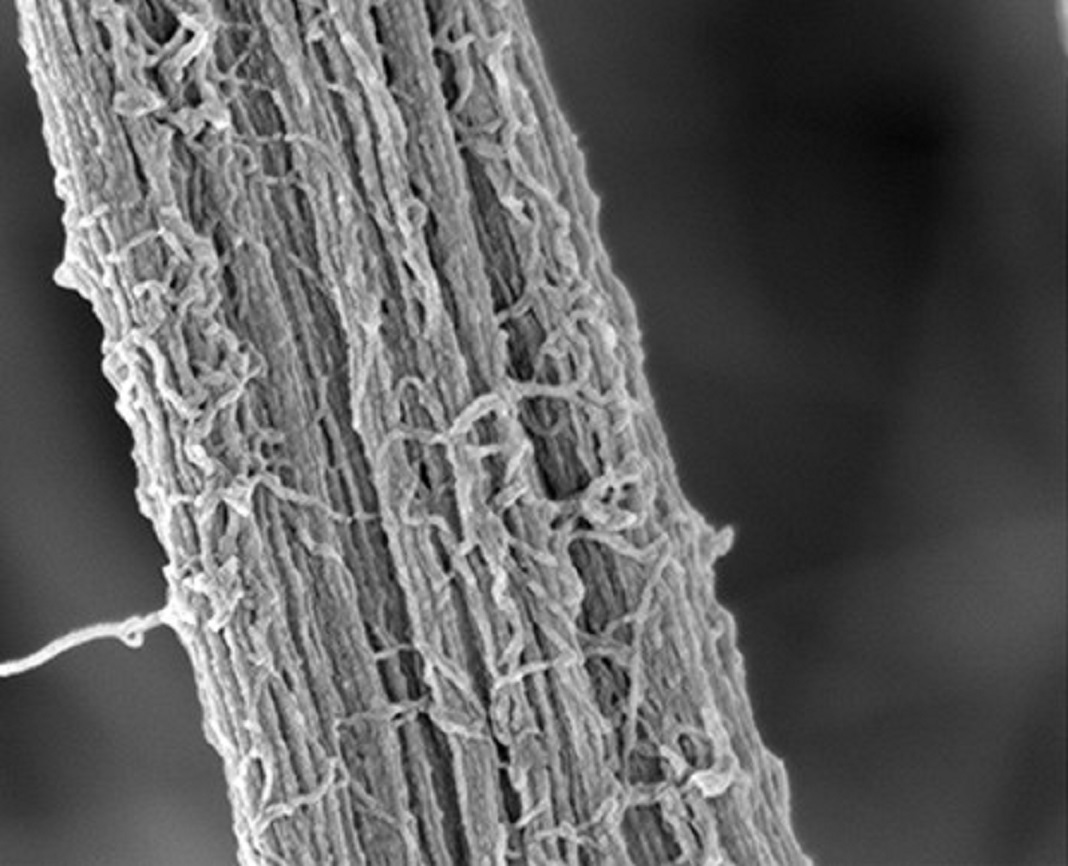 Zônulas normais consistem em feixes de microfibrilas. A perda de fibrilina-1 no epitélio ciliar não pigmentado resulta em feixes mais finos e fraco