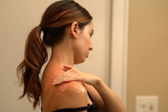 Prevenir e tratar erupções da pele mais comuns