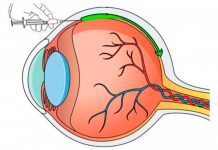 Nanopartículas melhoram eficácia de terapias genéticas para doenças oculares
