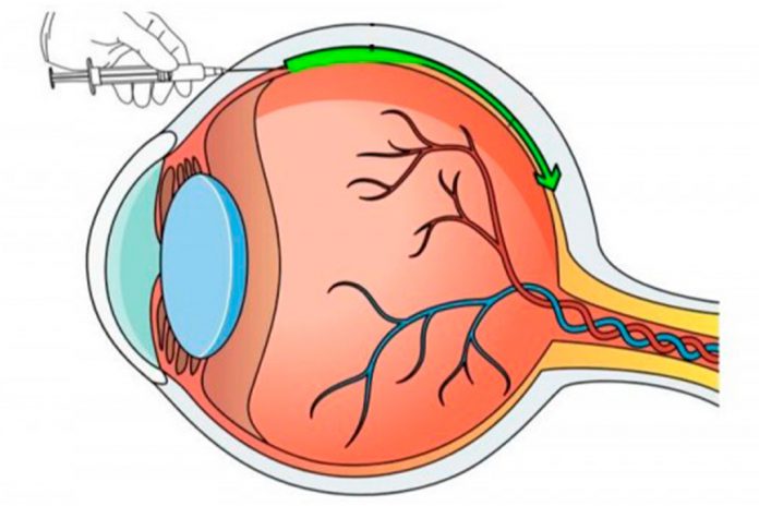 Nanopartículas melhoram eficácia de terapias genéticas para doenças oculares