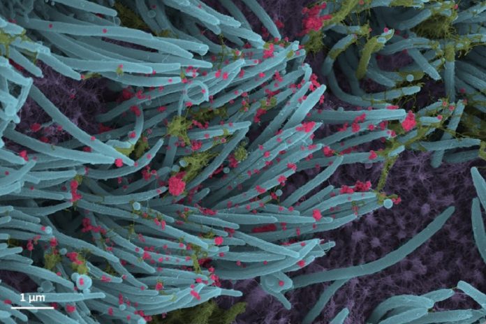 Imagens impressionantes de células infetadas com SARS-CoV-2