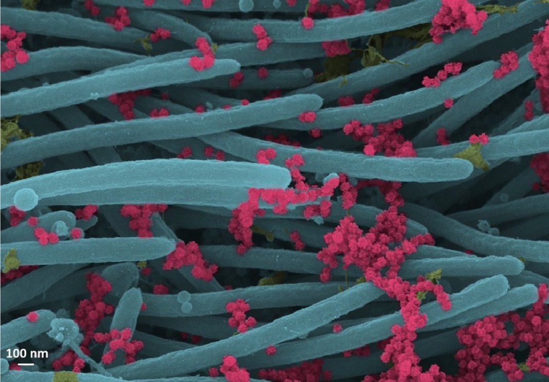Viriões SARS-CoV-2 (vermelho) produzidos por células humanas infetadas.