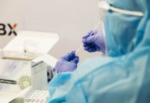 Testes rápidos para a COVID-19 precisos e acessíveis são uma prioridade