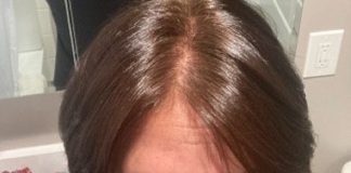 COVID-19 pode provocar perda excessiva de cabelo