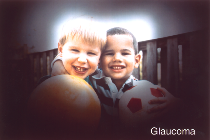 Uma representação fotográfica da perda de visão que uma pessoa com glaucoma pode sofrer.