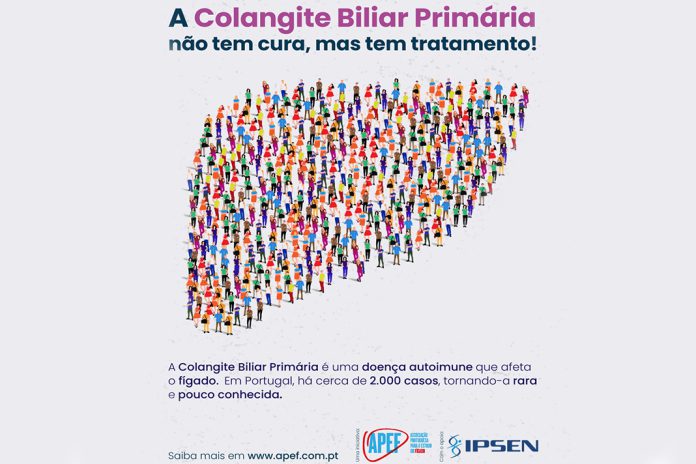 Importância do diagnóstico e tratamento da Colangite Biliar Primária