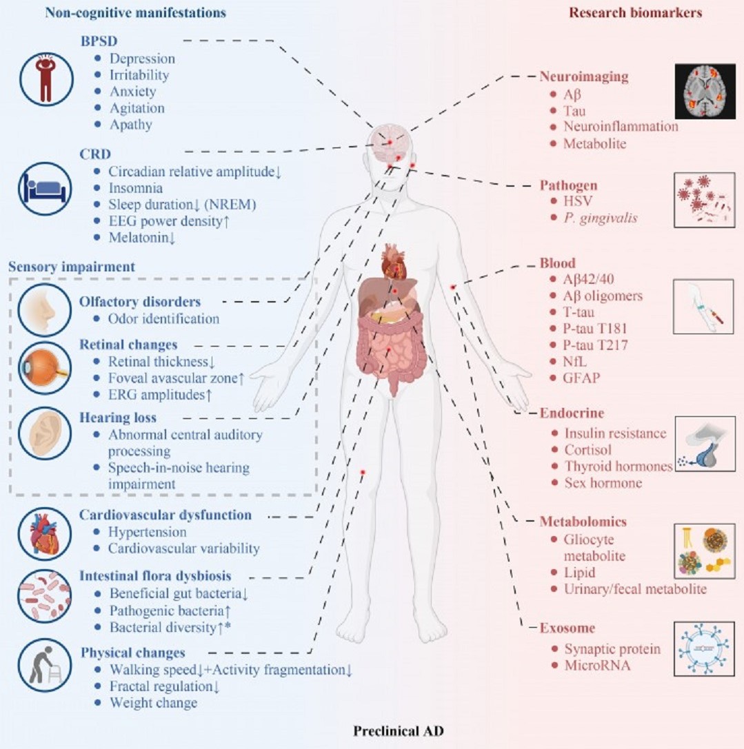 Avanços nas técnicas para diagnóstico precoce da doença de Alzheimer