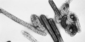 OMS: Etiópia confirma surto da doença do vírus de Marburg OMS: Etiópia confirma surto da doença do vírus de Marburg