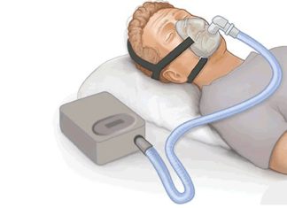 Nova ferramenta prevê como uso de CPAP afeta risco de doenças cardiovasculares em pacientes com apneia obstrutiva do sono Nova ferramenta prevê como uso de CPAP afeta risco de doenças cardiovasculares em pacientes com apneia obstrutiva do sono