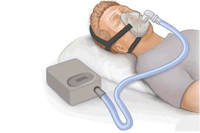 Nova ferramenta prevê como uso de CPAP afeta risco de doenças cardiovasculares em pacientes com apneia obstrutiva do sono Nova ferramenta prevê como uso de CPAP afeta risco de doenças cardiovasculares em pacientes com apneia obstrutiva do sono