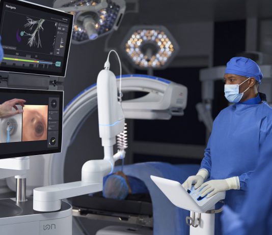 Broncoscopia assistida por robótica com o sistema endoluminal Ion já beneficiou 10 mil doentes na Europa